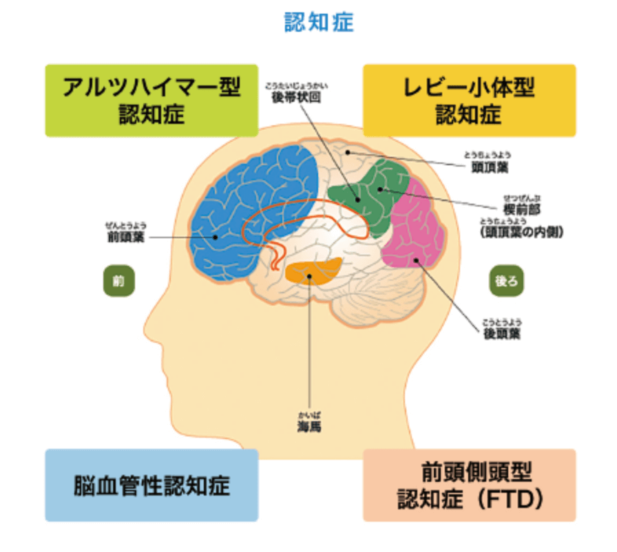 認知症